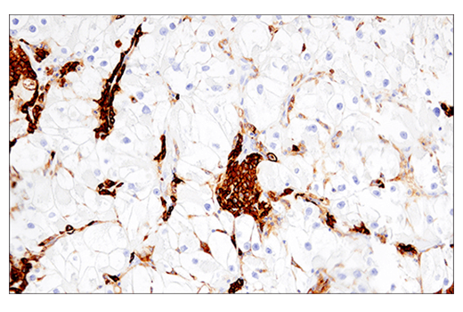 Immunohistochemistry Image 6: CD38 (E7Z8C) XP® Rabbit mAb