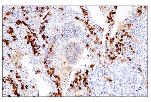 Immunohistochemistry Image 7: CD38 (E7Z8C) XP® Rabbit mAb