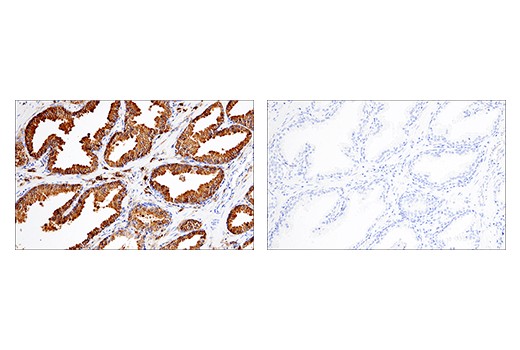 Immunohistochemistry Image 11: CD38 (E7Z8C) XP® Rabbit mAb