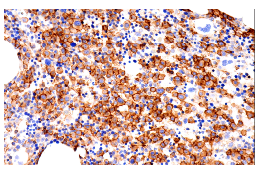 Immunohistochemistry Image 3: CD38 (E7Z8C) XP® Rabbit mAb