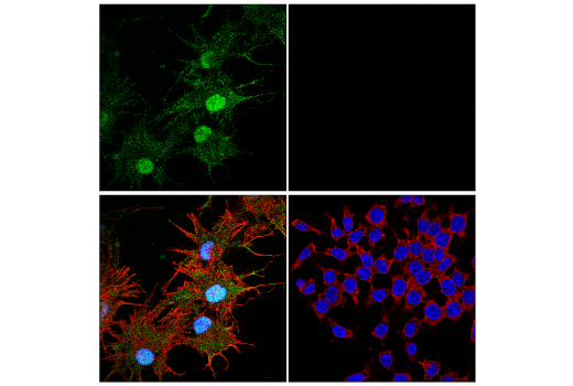 Immunofluorescence Image 3: α-Synuclein (E4U2F) XP® Rabbit mAb