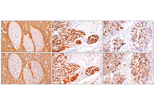 Immunohistochemistry Image 11: α-Synuclein (E4U2F) XP® Rabbit mAb