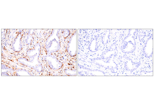 Immunohistochemistry Image 10: α-Synuclein (E4U2F) XP® Rabbit mAb