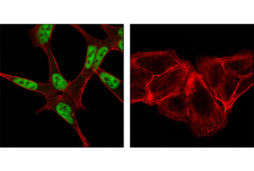 Immunofluorescence Image 1: Androgen Receptor (D6F11) XP® Rabbit mAb