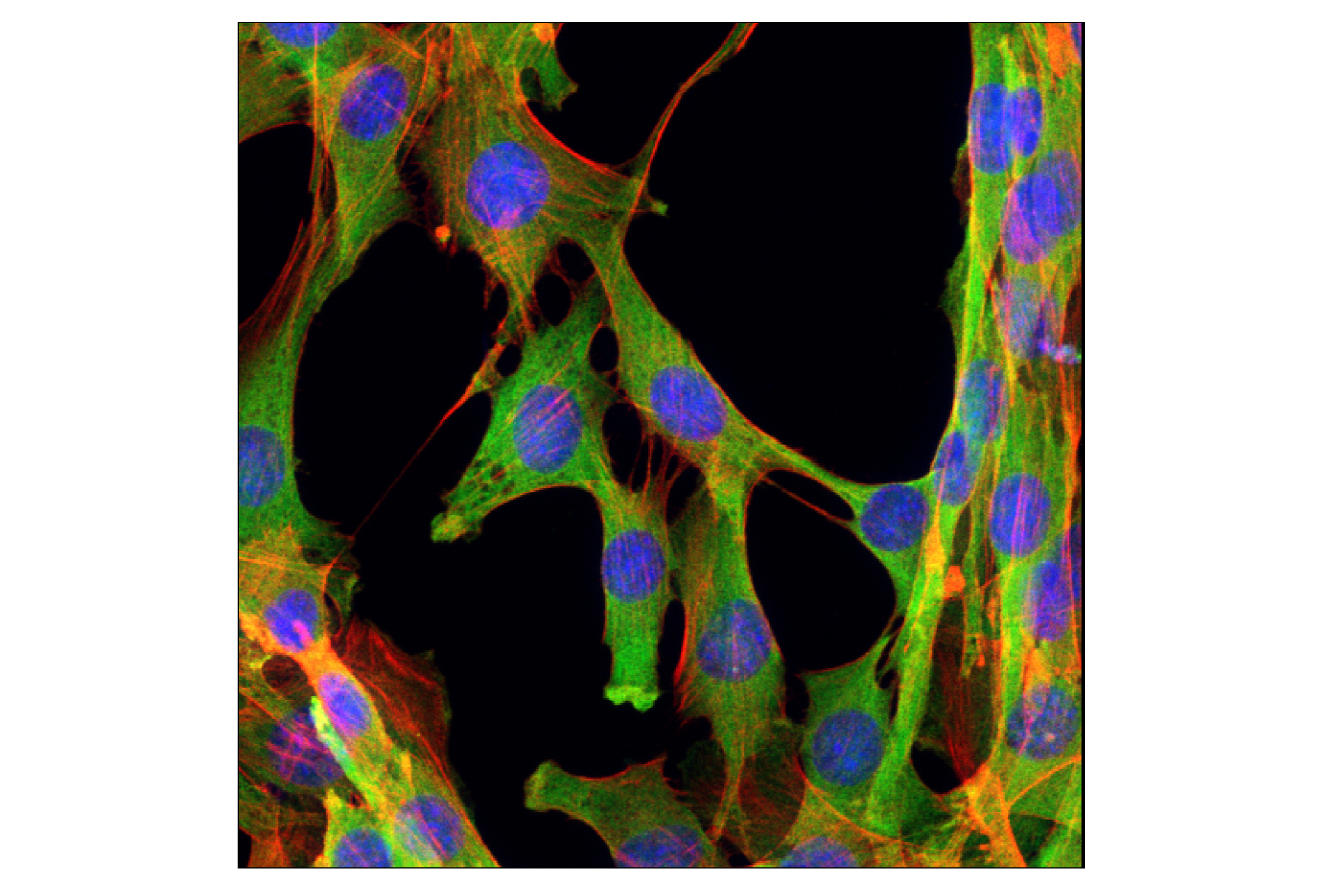 Immunofluorescence Image 1: GAPDH (D16H11) XP® Rabbit mAb