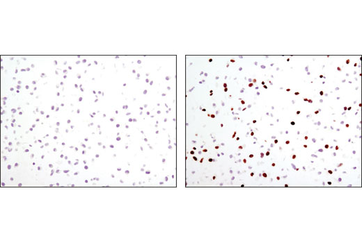 Immunohistochemistry Image 1: BrdU (Bu20a) Mouse mAb