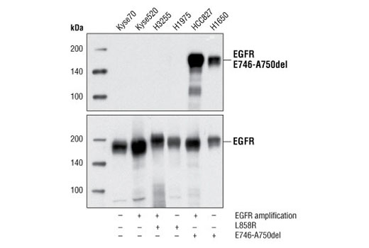 Western Blotting Image 1: EGF Receptor (E746-A750del Specific) (D6B6) XP® Rabbit mAb (BSA and Azide Free)