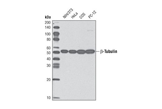  Image 4: Loading Control Antibody Sampler Kit (HRP Conjugate)