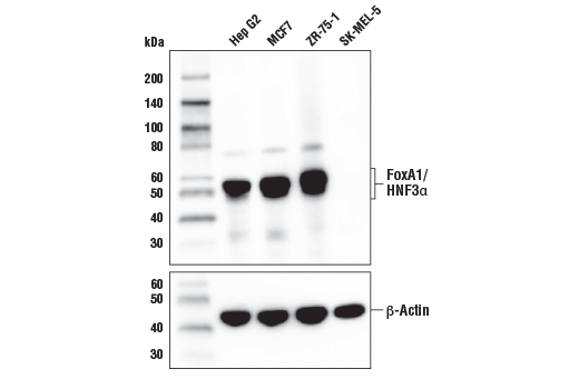 Western Blotting Image 1: FoxA1/HNF3α (E7E8W) Rabbit mAb