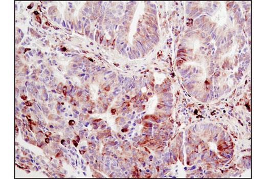 Immunohistochemistry Image 2: Phospho-S6 Ribosomal Protein (Ser240/244) (D68F8) XP® Rabbit mAb