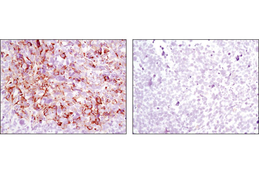  Image 25: p70 S6 Kinase Substrates Antibody Sampler Kit