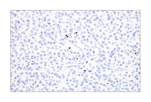 Immunohistochemistry Image 1: T-bet/TBX21 (E4I2K) Rabbit mAb (BSA and Azide Free)