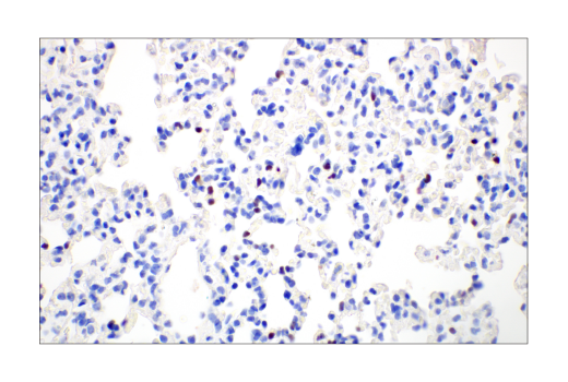 Immunohistochemistry Image 3: T-bet/TBX21 (E4I2K) Rabbit mAb (BSA and Azide Free)