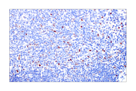 Immunohistochemistry Image 6: T-bet/TBX21 (E4I2K) Rabbit mAb (BSA and Azide Free)