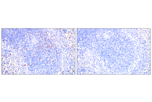 Immunohistochemistry Image 5: T-bet/TBX21 (E4I2K) Rabbit mAb (BSA and Azide Free)
