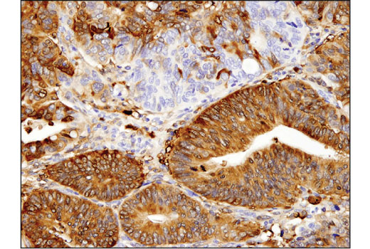 Immunohistochemistry Image 1: ALDH1A1 (D9Q8E) XP® Rabbit mAb