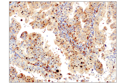 Immunohistochemistry Image 1: Galectin-9 (D9R4A) XP® Rabbit mAb