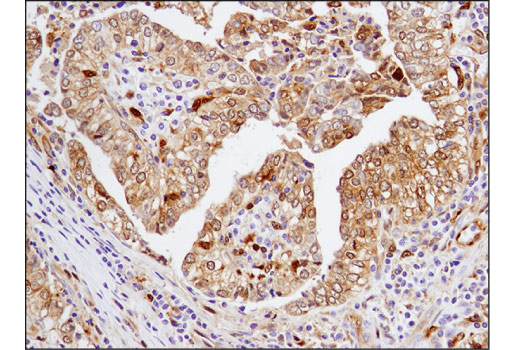 Immunohistochemistry Image 3: Galectin-9 (D9R4A) XP® Rabbit mAb (BSA and Azide Free)