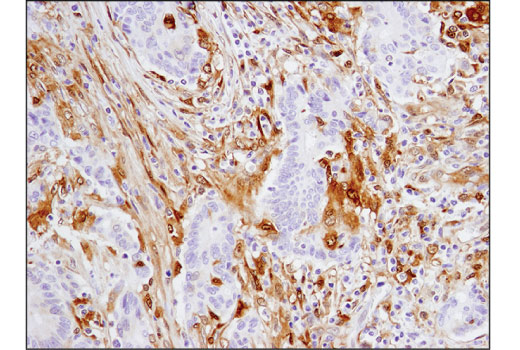 Immunohistochemistry Image 3: Galectin-9 (D9R4A) XP® Rabbit mAb