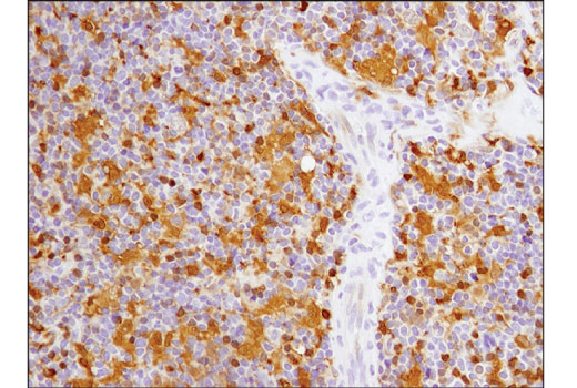 Immunohistochemistry Image 6: Galectin-9 (D9R4A) XP® Rabbit mAb (BSA and Azide Free)