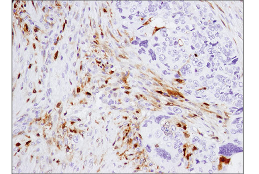 Immunohistochemistry Image 5: Galectin-9 (D9R4A) XP® Rabbit mAb