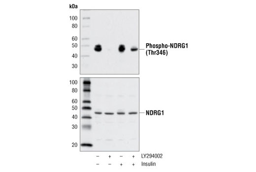 Western Blotting Image 1: Phospho-NDRG1 (Thr346) (D98G11) XP® Rabbit mAb