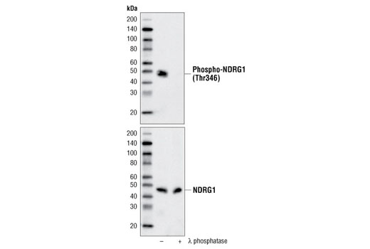 Western Blotting Image 2: Phospho-NDRG1 (Thr346) (D98G11) XP® Rabbit mAb