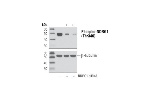 Western Blotting Image 3: Phospho-NDRG1 (Thr346) (D98G11) XP® Rabbit mAb