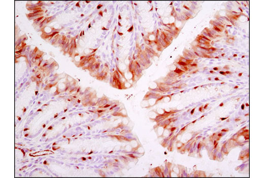 Immunohistochemistry Image 2: Phospho-NDRG1 (Thr346) (D98G11) XP® Rabbit mAb