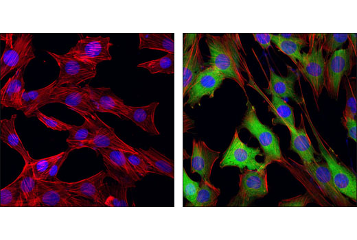 Immunofluorescence Image 4: Phospho-NDRG1 (Thr346) (D98G11) XP® Rabbit mAb