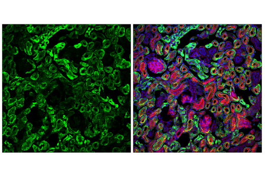 Immunofluorescence Image 2: Phospho-NDRG1 (Thr346) (D98G11) XP® Rabbit mAb