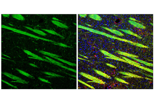 Immunofluorescence Image 3: Phospho-NDRG1 (Thr346) (D98G11) XP® Rabbit mAb