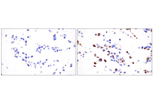 Immunohistochemistry Image 2: Histone H3 (K9M Mutant Specific) (E4N7V) Rabbit mAb