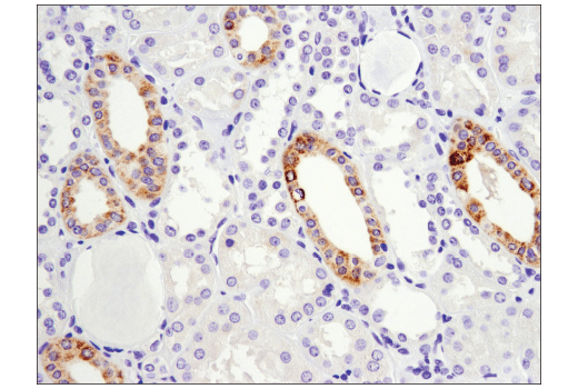 Immunohistochemistry Image 1: Arginase-2 (D9J1N) XP® Rabbit mAb