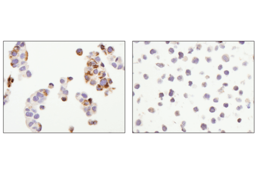 Immunohistochemistry Image 2: Arginase-2 (D9J1N) XP® Rabbit mAb