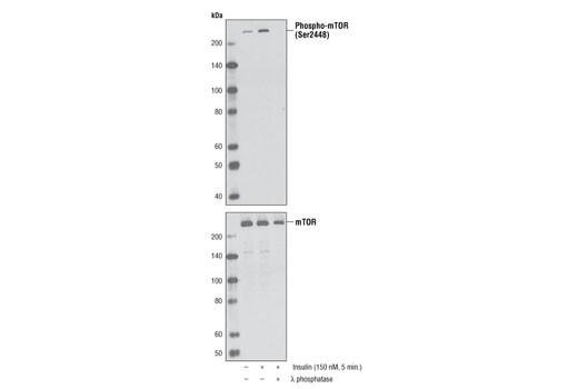  Image 15: Cannabinoid Receptor 1 Downstream Signaling Antibody Sampler Kit