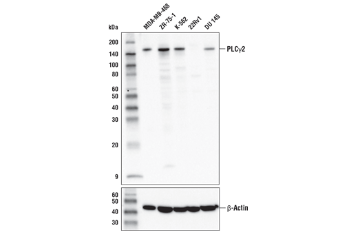  Image 2: PhosphoPlus® PLCγ2 (Tyr759) Antibody Duet
