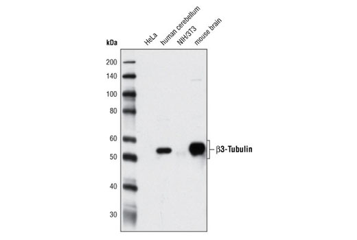 Western Blotting Image 1: β3-Tubulin (D71G9) XP® Rabbit mAb