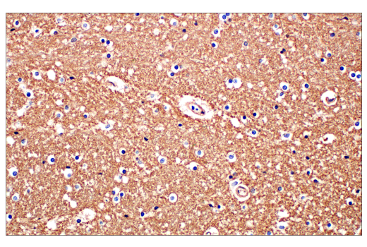  Image 37: Human Reactive Exosome Marker Antibody Sampler Kit