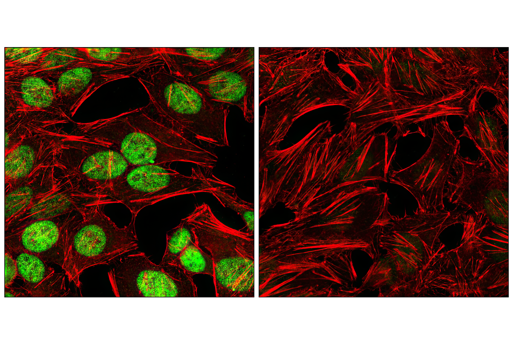  Image 18: StemLight™ iPS Cell Reprogramming Antibody Kit