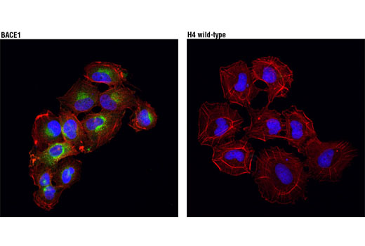  Image 20: Alzheimer's Disease Antibody Sampler Kit