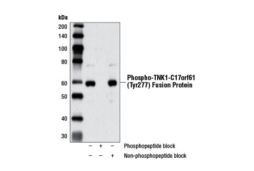 Western Blotting Image 1: Phospho-TNK1 (Tyr277) (D46E7) Rabbit mAb