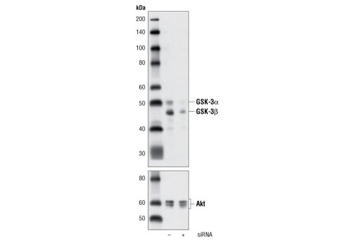 Western Blotting Image 2: GSK-3α/β (D75D3) Rabbit mAb