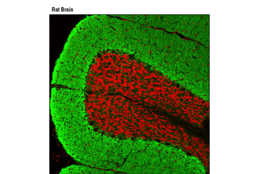  Image 8: Astrocyte Markers Antibody Sampler Kit