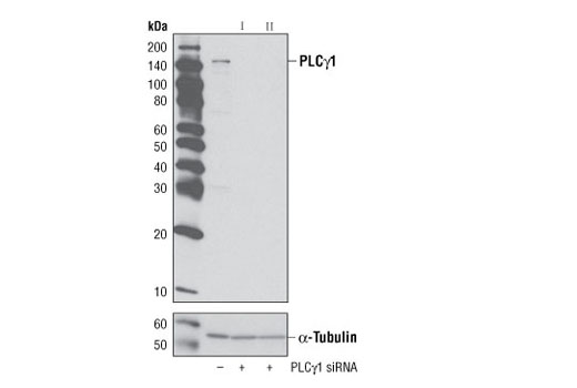  Image 23: TREM2 Signaling Pathways Antibody Sampler Kit