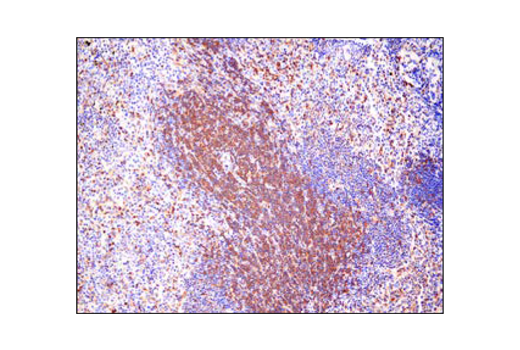  Image 37: TREM2 Signaling Pathways Antibody Sampler Kit