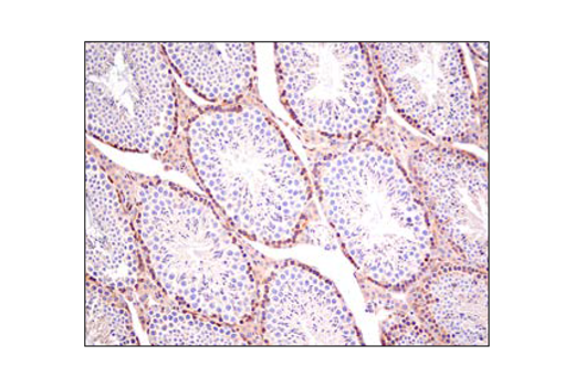  Image 39: TREM2 Signaling Pathways Antibody Sampler Kit