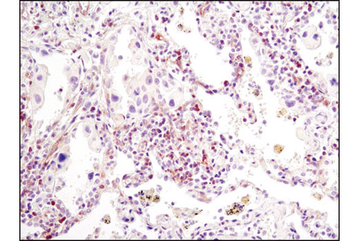 Immunohistochemistry Image 5: PLCγ1 (D9H10) XP® Rabbit mAb