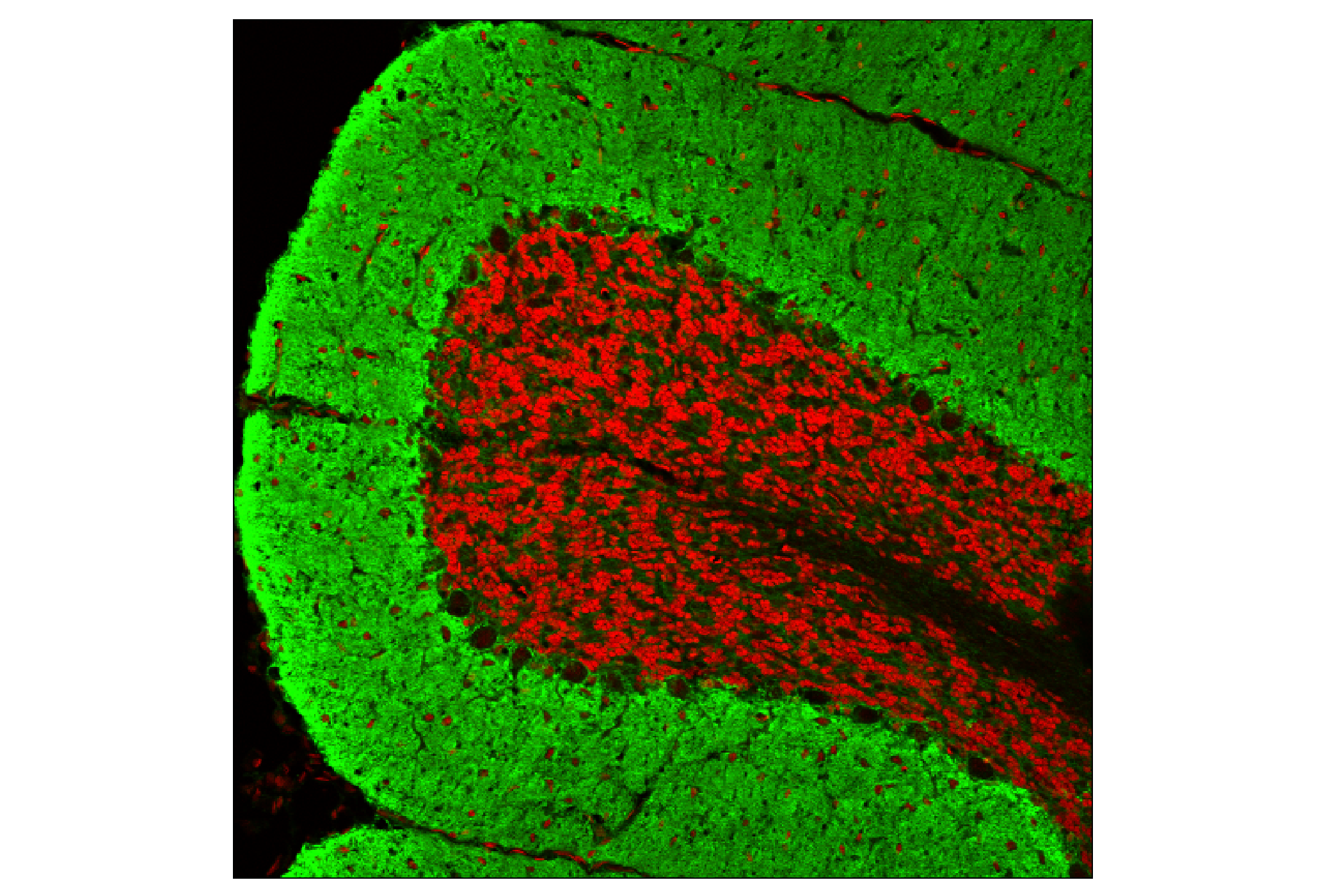 Immunofluorescence Image 1: EAAT1 (D44E2) XP® Rabbit mAb (BSA and Azide Free)