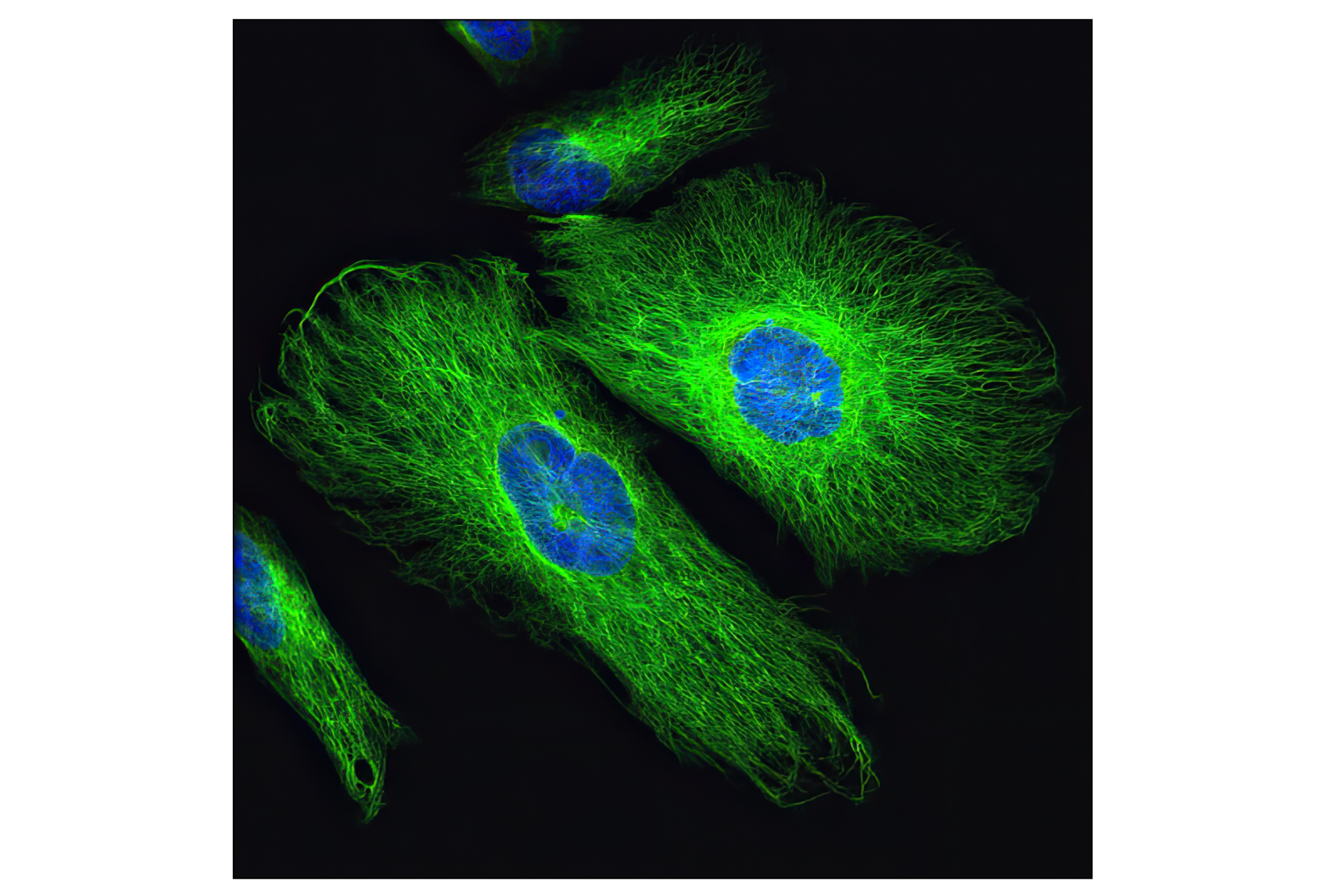 Immunofluorescence Image 1: Vimentin (D21H3) XP® Rabbit mAb